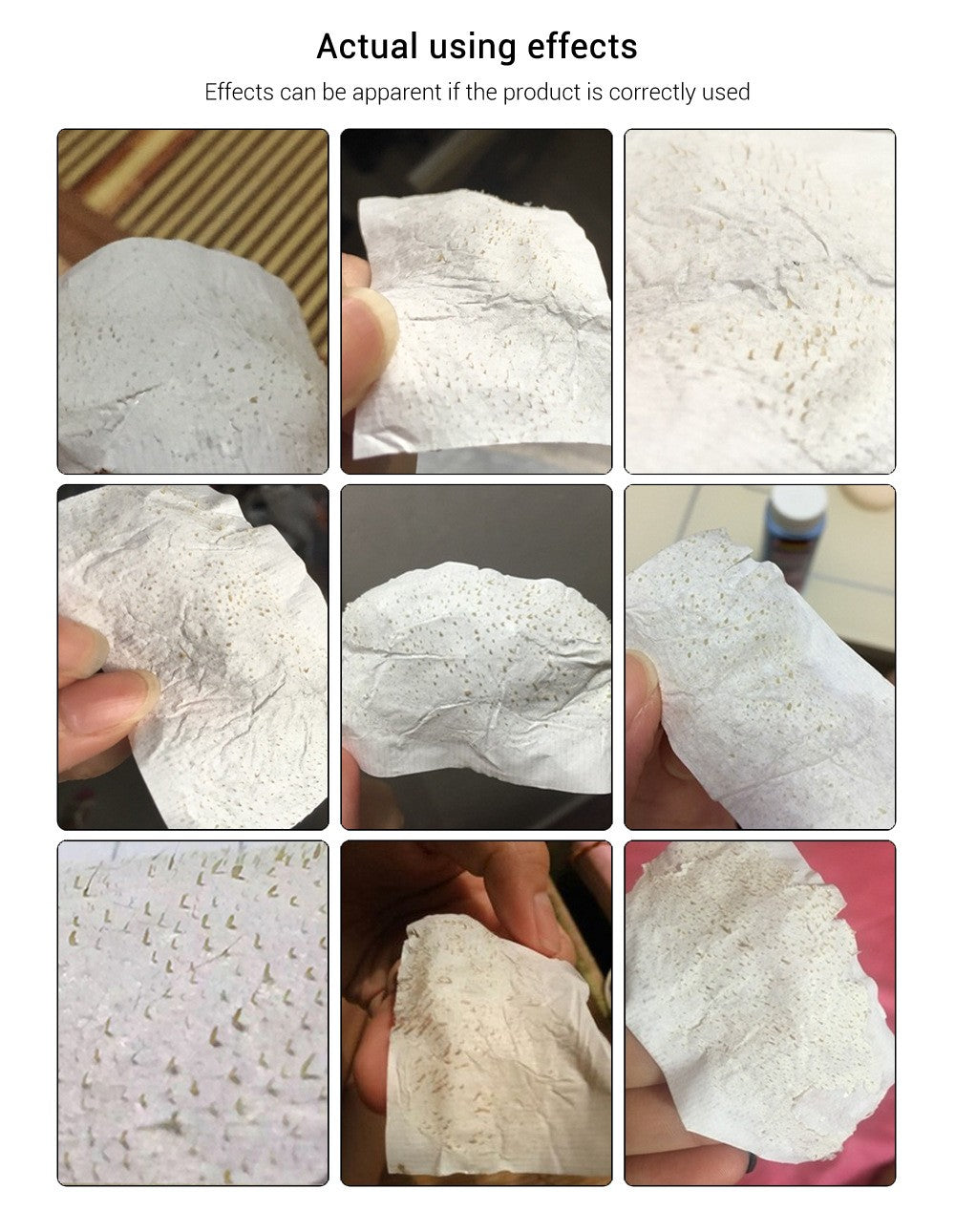 LANBENA Blackhead Remover Strips