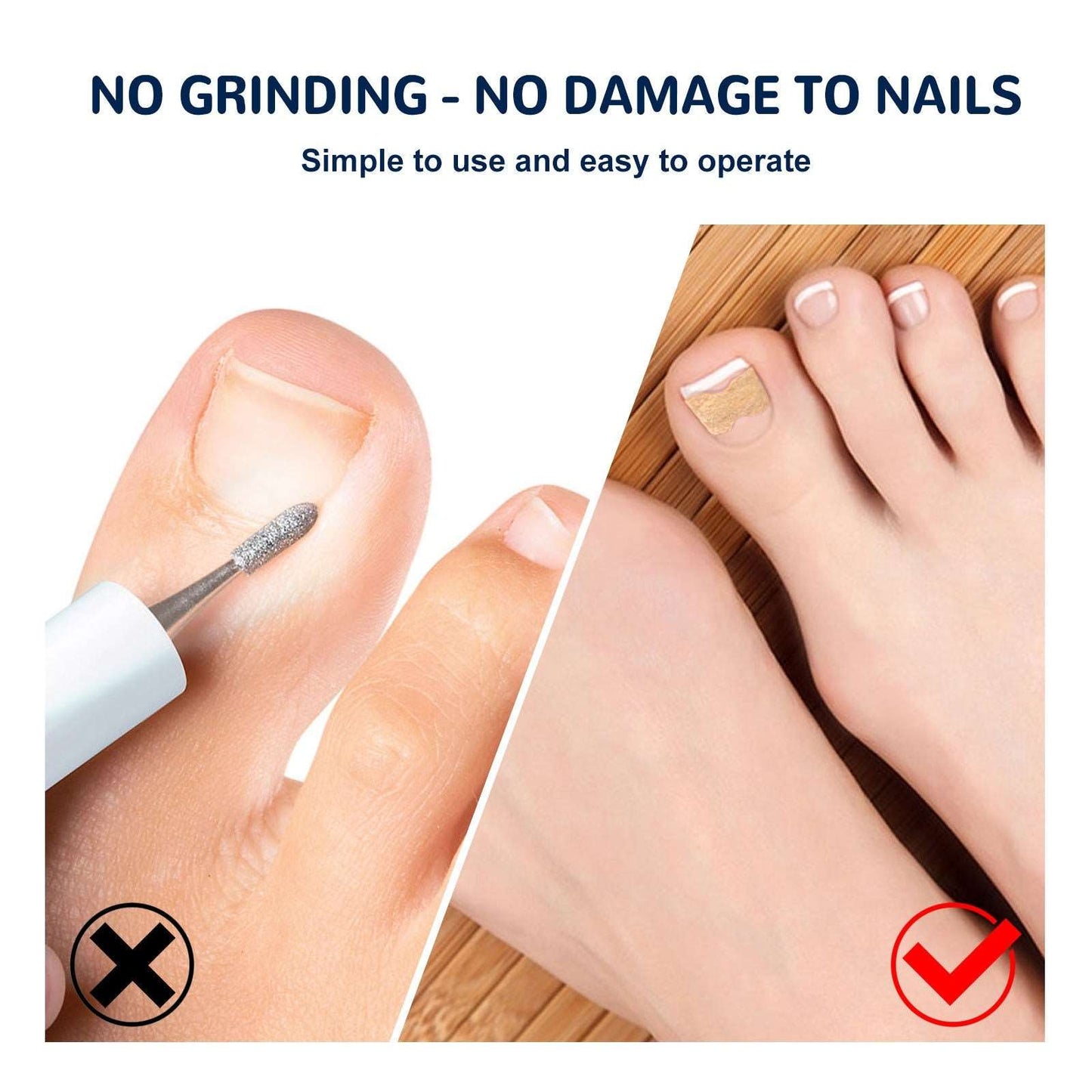 EELHOE toe nail correction patch