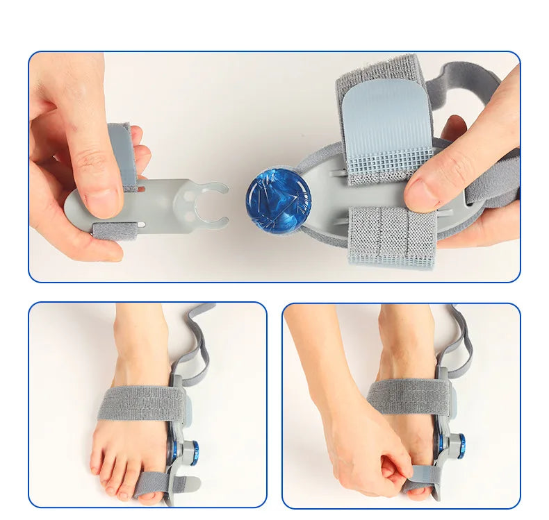 Bunion Corrector; Rotatable Toe Separator